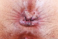 ATK hairy Gemma Naya in exotic and hairy