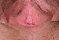 ATK hairy Geneva Set