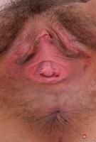 ATK hairy Geneva Set