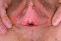 ATK hairy Geneva Set