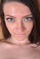 ATK hairy  in young and hairy