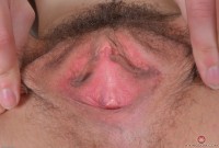 ATK hairy Geneva Set