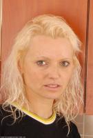 ATK hairy  in mature and hairy