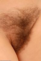 ATK hairy  in mature and hairy