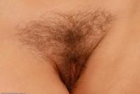 ATK hairy  in mature and hairy