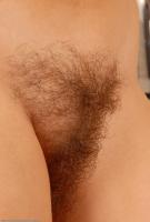 ATK hairy  in mature and hairy