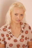 ATK hairy  in mature and hairy