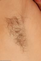 ATK hairy  in mature and hairy