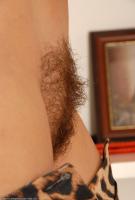 ATK hairy  in mature and hairy