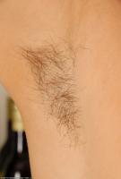 ATK hairy  in mature and hairy