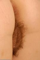 ATK hairy  in mature and hairy