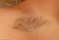 ATK hairy  in mature and hairy