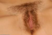 ATK hairy  in mature and hairy