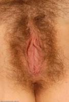 ATK hairy  in mature and hairy