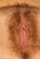ATK hairy  in mature and hairy
