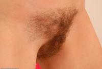 ATK hairy  in mature and hairy
