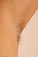 ATK hairy  in mature and hairy