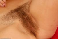 ATK hairy  in mature and hairy