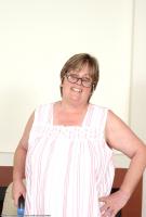 ATK hairy  in mature and hairy