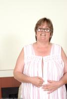 ATK hairy  in mature and hairy