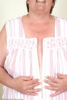 ATK hairy  in mature and hairy