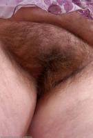 ATK hairy  in mature and hairy