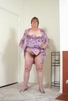 ATK hairy  in mature and hairy