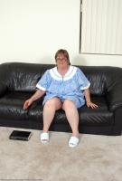 ATK hairy  in mature and hairy