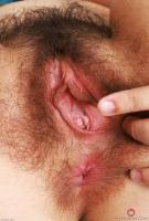 ATK hairy  in young and hairy