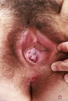 ATK hairy Gigi Set