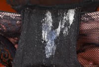 ATK hairy  in young and hairy