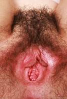 ATK hairy  in young and hairy