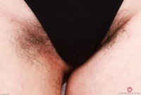 ATK hairy  in young and hairy