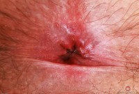 ATK hairy  in hairy fun