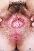 ATK hairy  in young and hairy