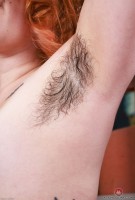 ATK hairy  in young and hairy