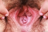 ATK hairy  in young and hairy