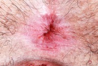 ATK hairy Gigi in young and hairy