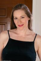 ATK hairy  in mature and hairy