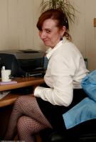 ATK hairy  in mature and hairy