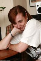 ATK hairy  in mature and hairy