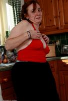 ATK hairy  in mature and hairy