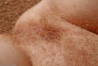 ATK hairy Gingerbabe Set