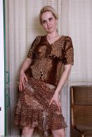 ATK hairy  in mature and hairy