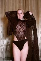 ATK hairy  in mature and hairy