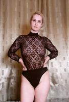 ATK hairy  in mature and hairy
