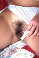 ATK hairy  in young and hairy