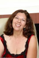 ATK hairy  in mature and hairy