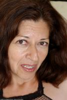 ATK hairy  in mature and hairy