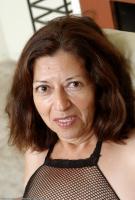 ATK hairy  in mature and hairy